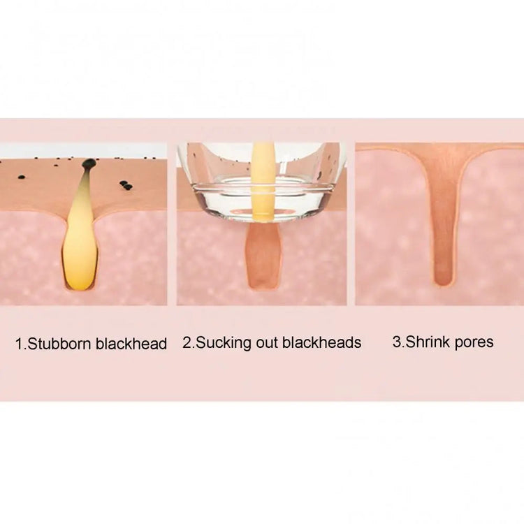 Blackhead Remover Pore Vacuum Cleaner Face Skin Care Sucker
