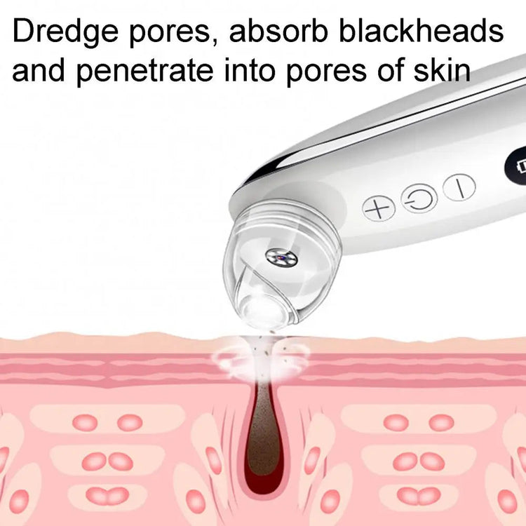 Blackhead Remover Pore Vacuum Cleaner Face Skin Care Sucker