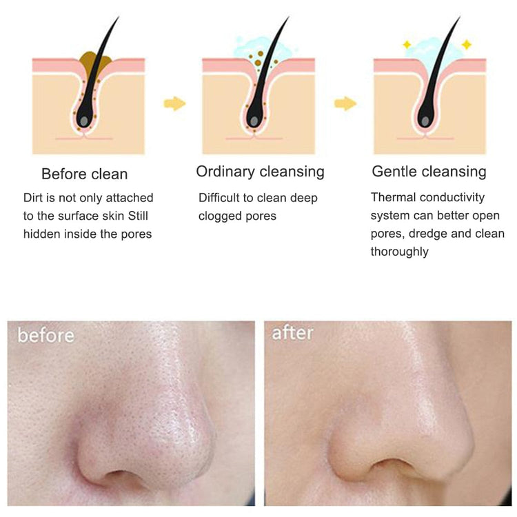 Electric cleanser Facial Cleansing Brush Face Skin Care Tools